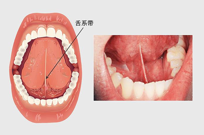 孩子語言障礙怎麽辦？